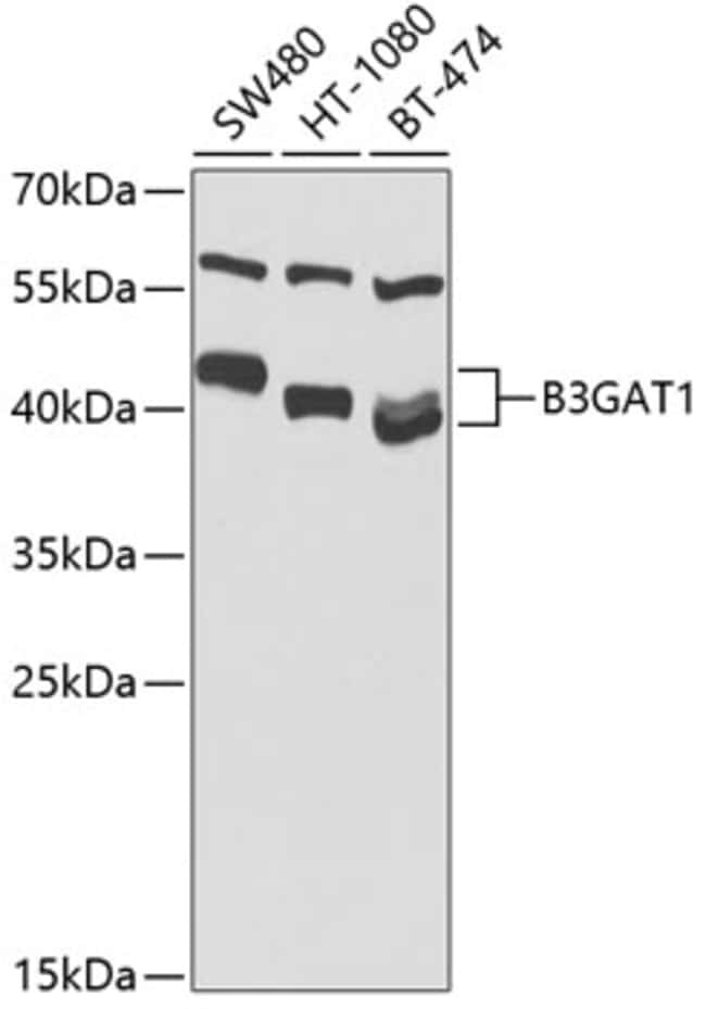 100UL CD57 ANTIBODY 100 ul