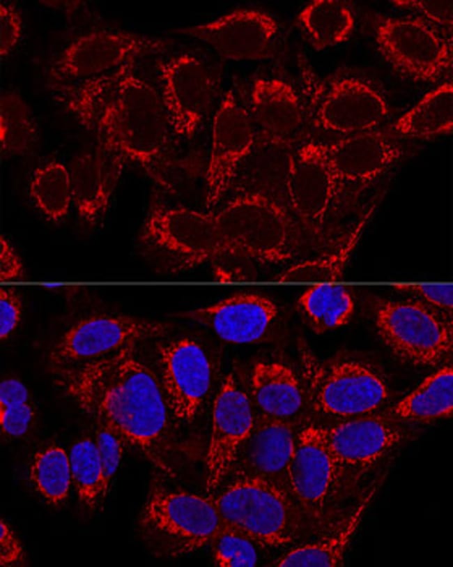100UL MRPS16 ANTIBODY 100 ul