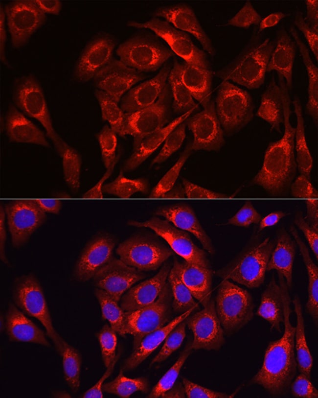100UL MFN1 ANTIBODY 100 ul
