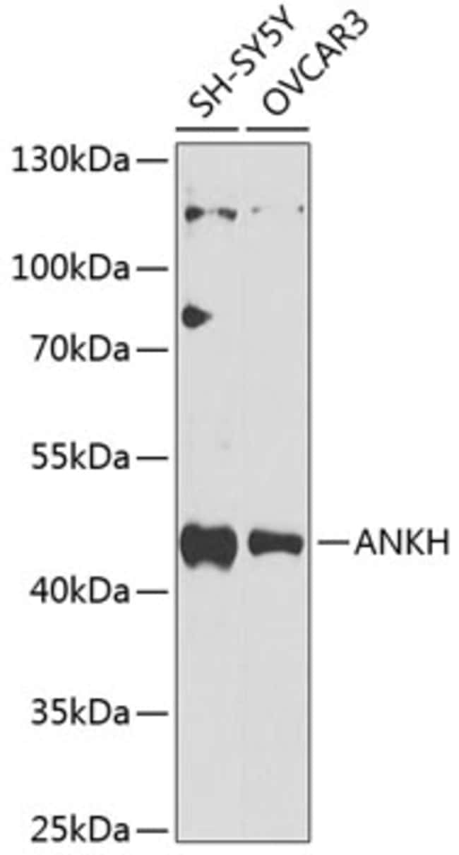 100UL ANKH ANTIBODY 100 ul