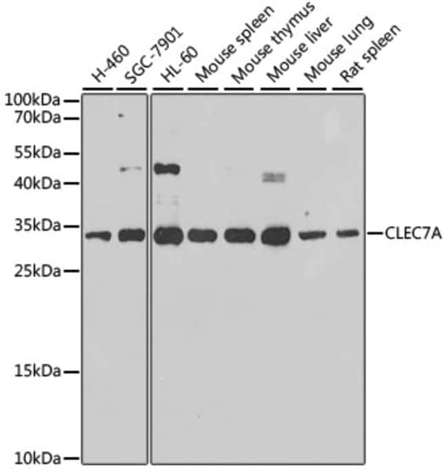 100UL DECTIN-1 ANTIBODY 100 ul
