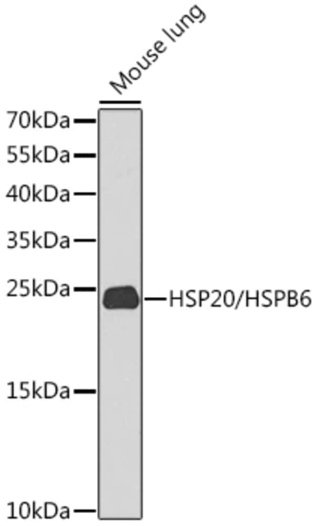 100UL HSP20 ANTIBODY 100 ul