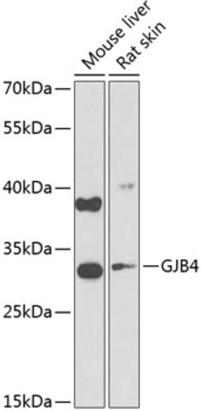 100UL CONNEXIN 30.3 ANTIBODY 100 ul