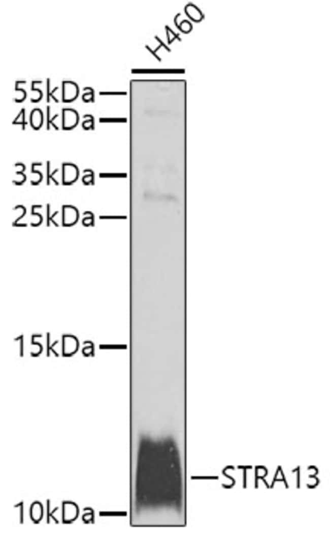 100UL BHLHE40 ANTIBODY 100 ul