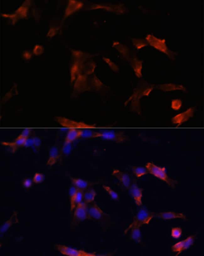 100UL AQUAPORIN 5 ANTIBODY 100 ul