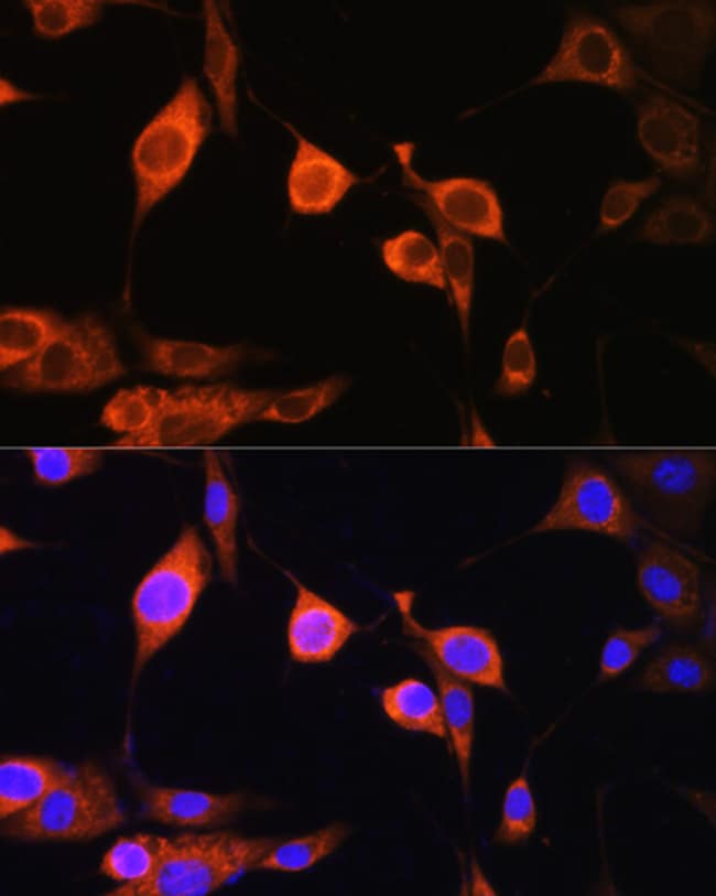 100UL ATP5D ANTIBODY 100 ul