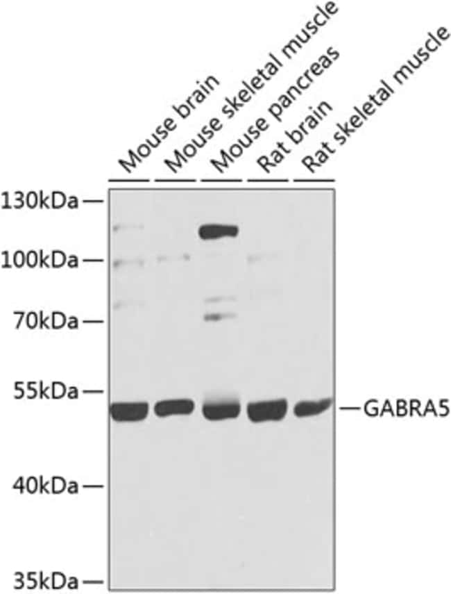 100UL GABRA5 ANTIBODY 100 ul