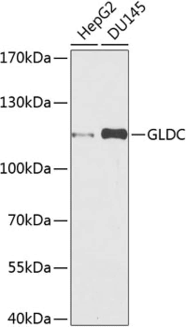 100UL GLDC ANTIBODY 100 ul