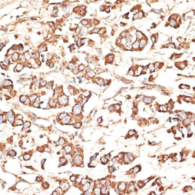 100UL KIR3DS1 ANTIBODY 100 ul
