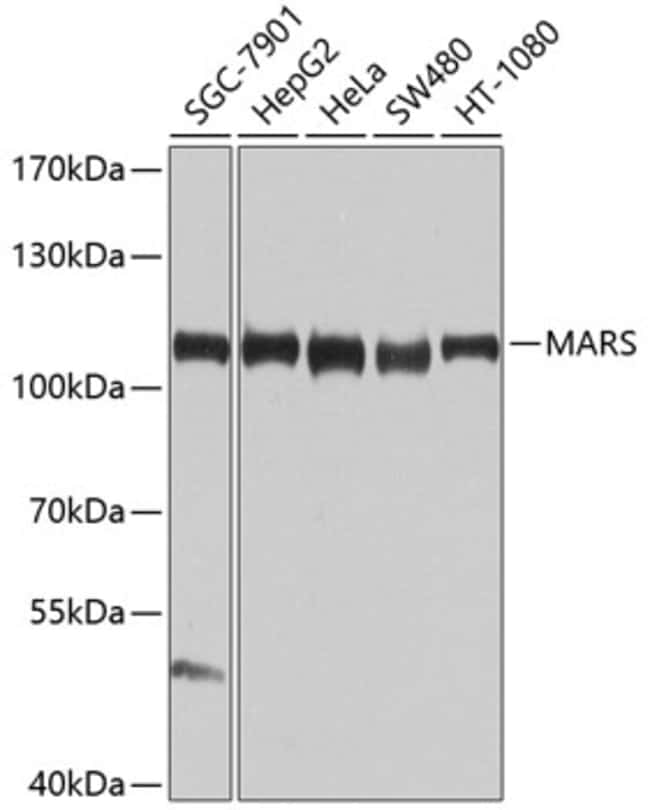 100UL MARS ANTIBODY 100 ul