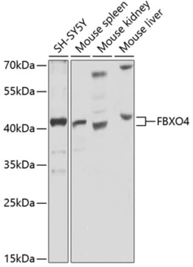 100UL FBXO4 ANTIBODY 100 ul
