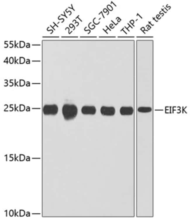 100UL EIF3K ANTIBODY 100 ul