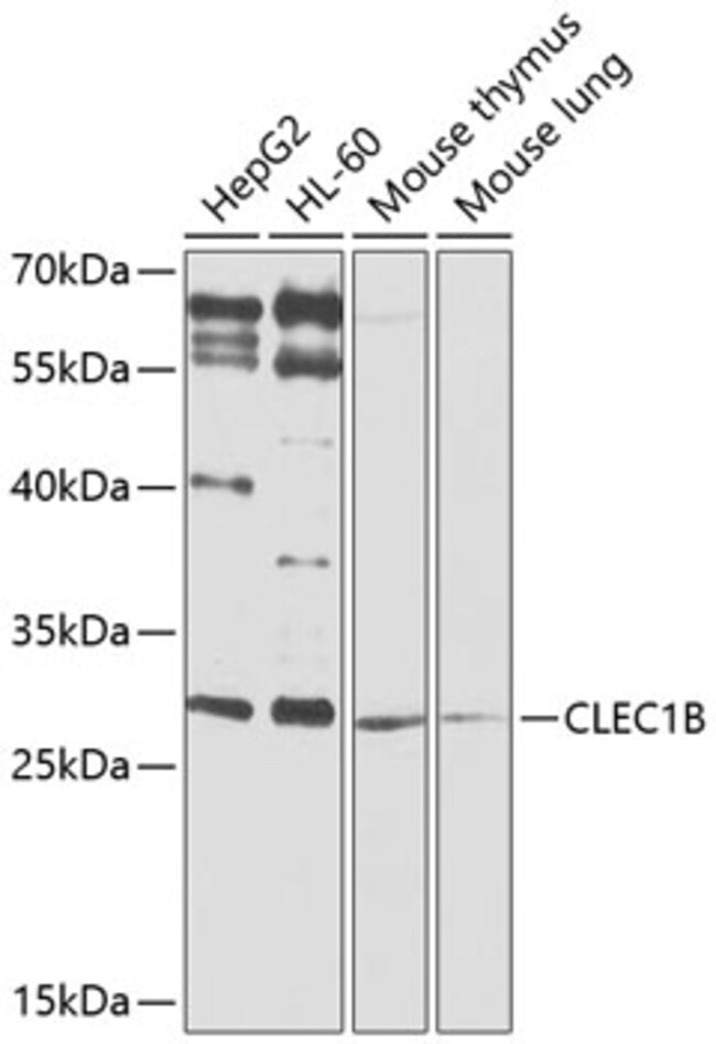 100UL CLEC1B ANTIBODY 100 ul
