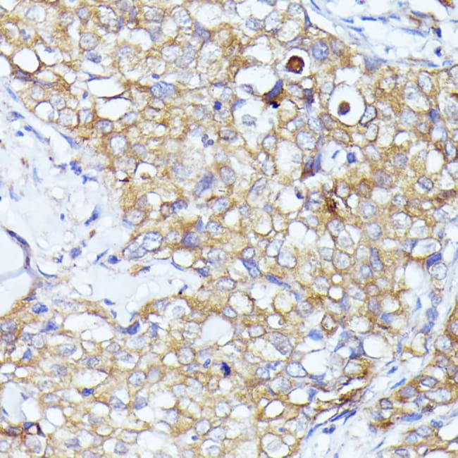 100UL EIF3L ANTIBODY 100 ul