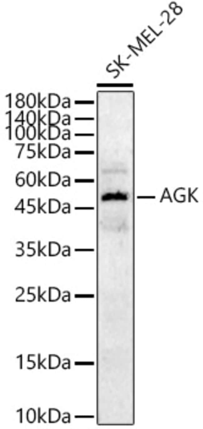100UL AGK ANTIBODY 100 ul