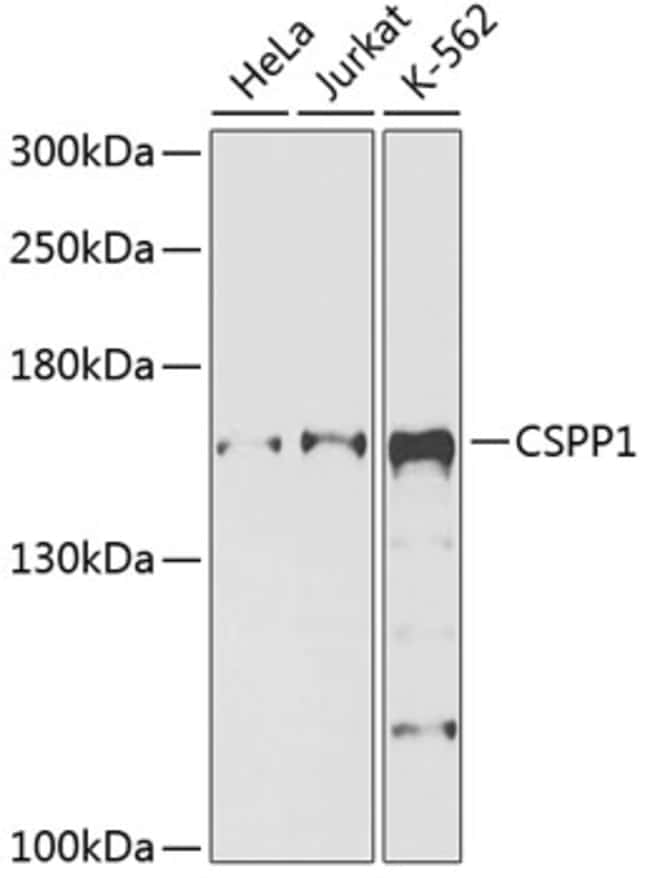 100UL CSPP1 ANTIBODY 100 ul