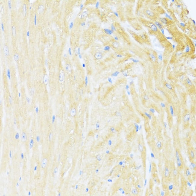 100UL MNF1 ANTIBODY 100 ul