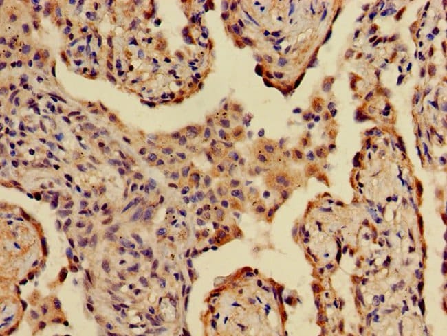 100UG A2ML1 ANTIBODY 100 ug