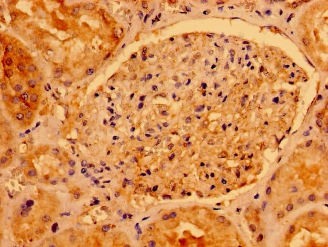 100UG AACS ANTIBODY 100 ug