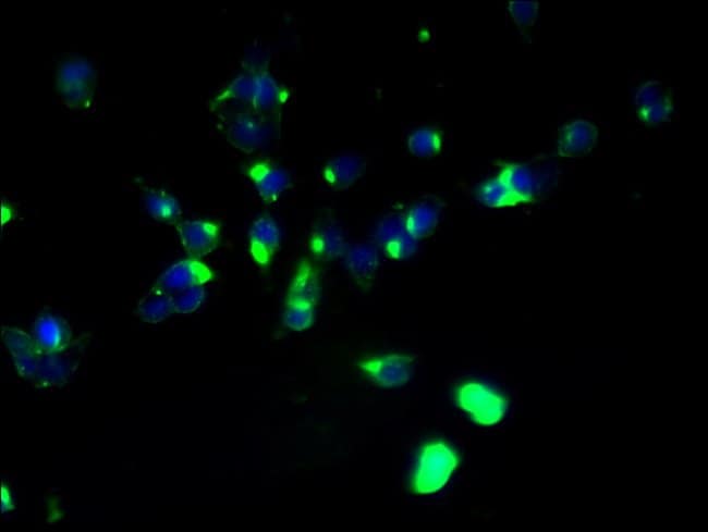 100UG ABHD2 ANTIBODY 100 ug