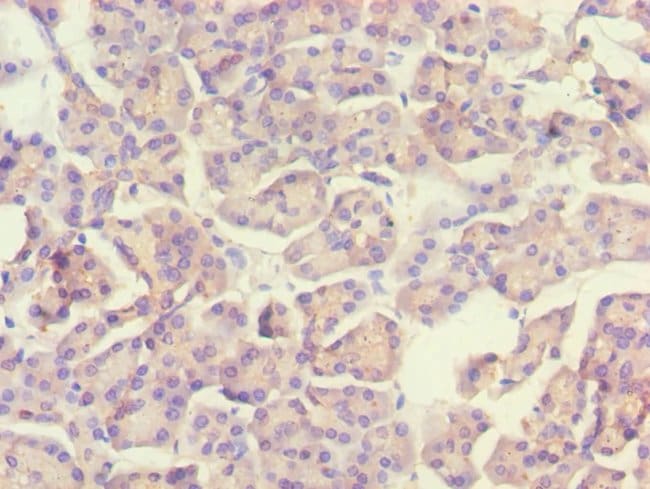 100UL ACADS ANTIBODY 100 ul