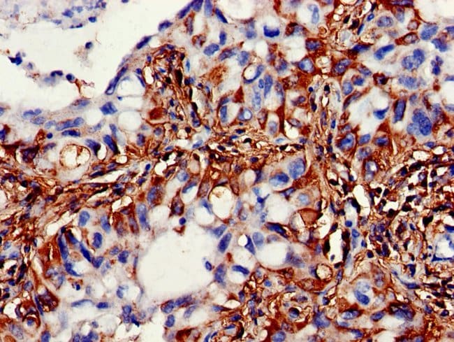 100UG SBCAD ANTIBODY 100 ug