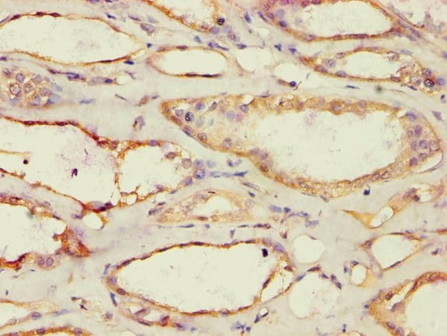 100UL ACAT1 ANTIBODY 100 ul