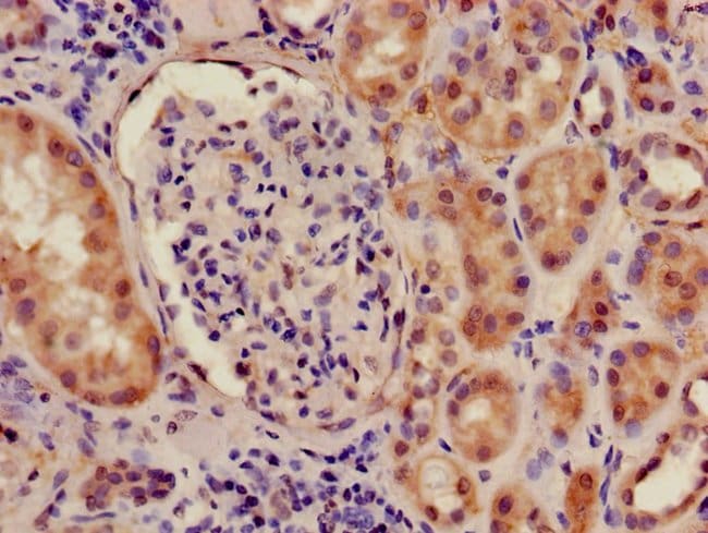 100UG ILF2 ANTIBODY 100 ug