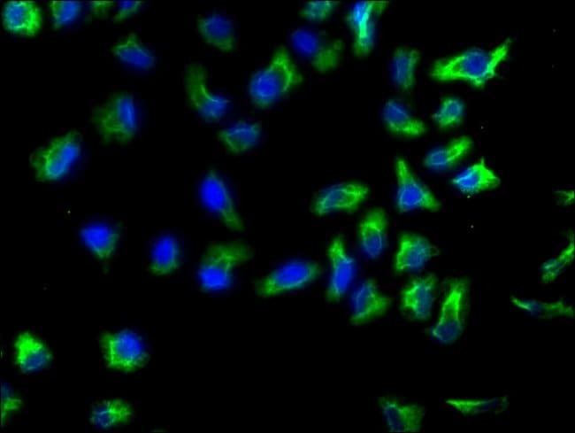 100UL ALPHA ACTININ 1 ANTIBODY 100 ul