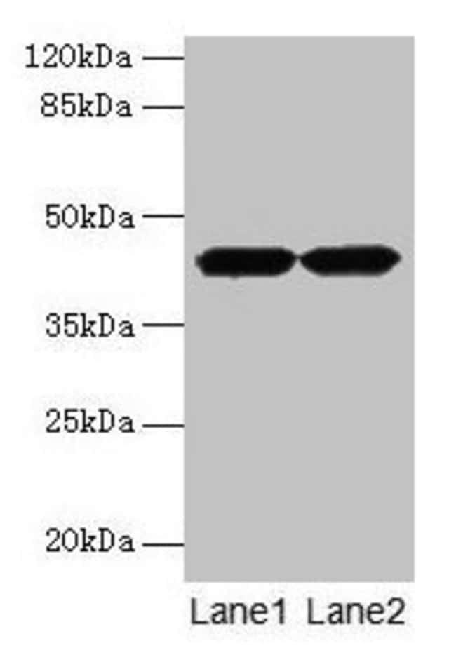 100UG ACTRT2 ANTIBODY 100 ug