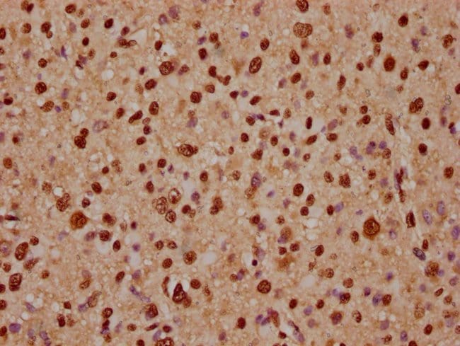 100UL ADAR1 ANTIBODY 100 ul