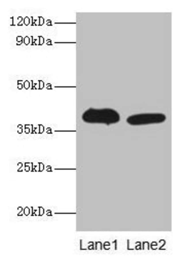 100UG ADH5 ANTIBODY 100 ug