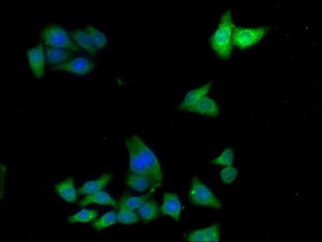 100UG ADH7 ANTIBODY