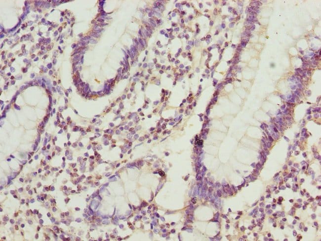 100UL ADPGK ANTIBODY 100 ul