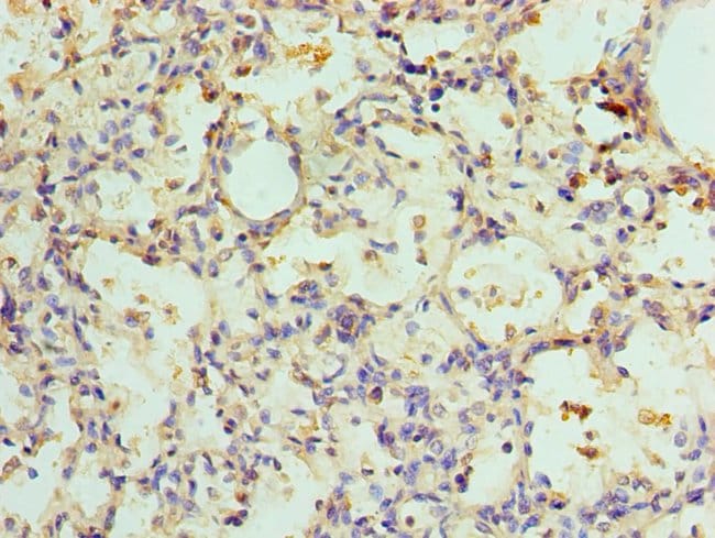 100UL ADSL ANTIBODY 100 ul