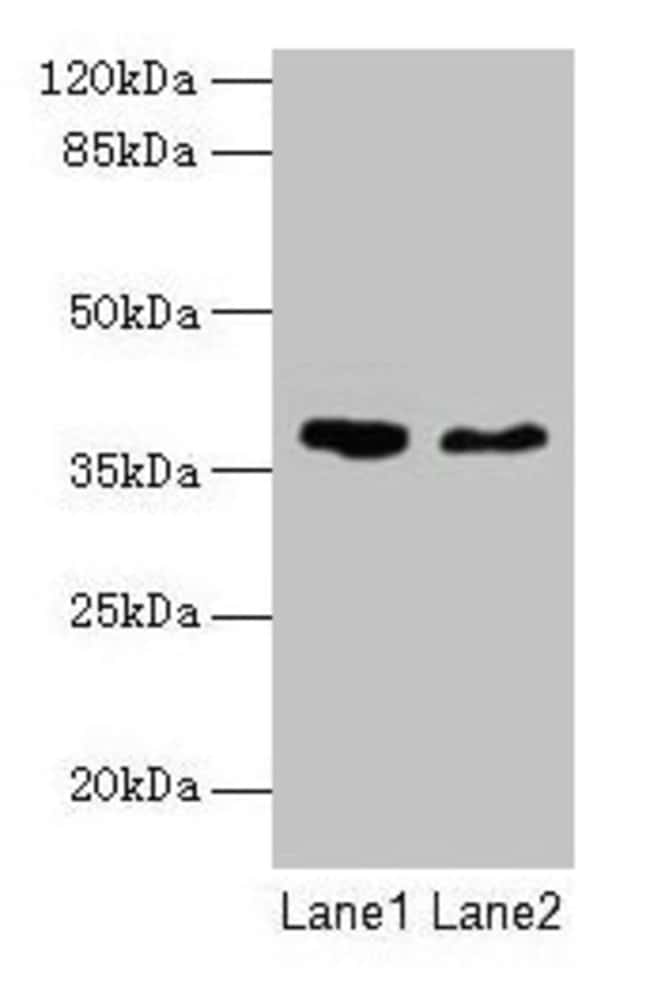 100UG AGA ANTIBODY 100 ug
