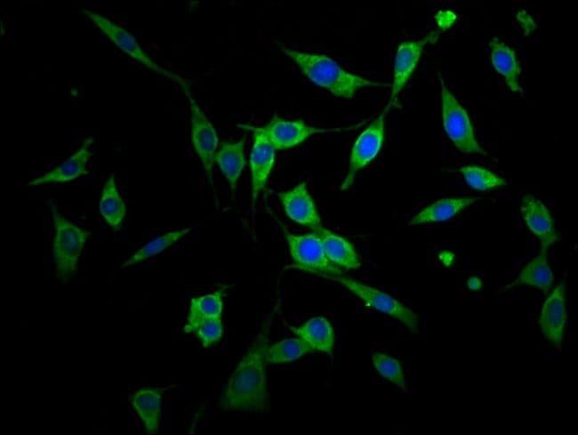 100UG AGPS ANTIBODY 100 ug