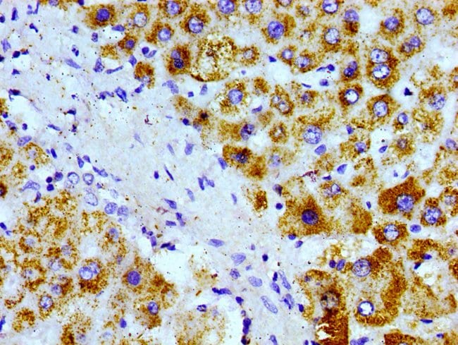 100UG AGXT ANTIBODY 100 ug
