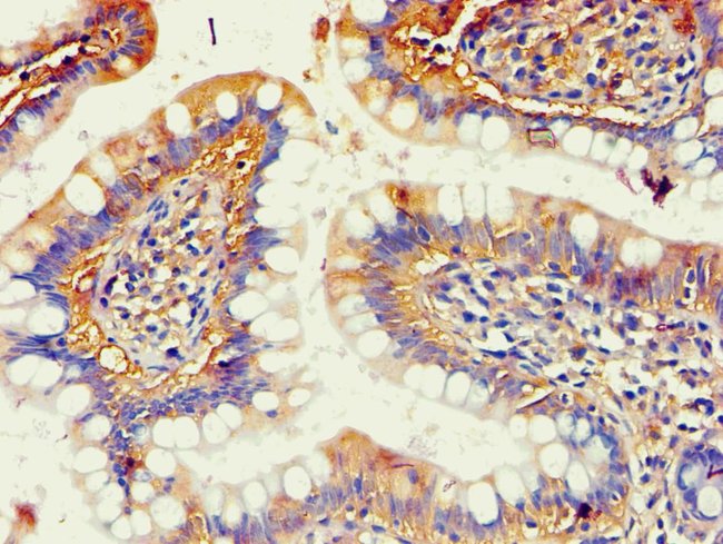 100UL AKR1B10 ANTIBODY 100 ul