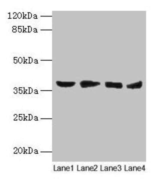 100UG AKR1C2 ANTIBODY 100 ug