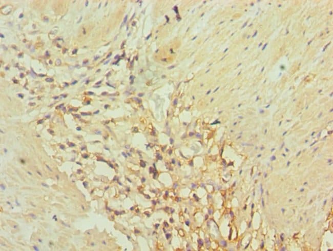 100UL AKR1C3 ANTIBODY 100 ul