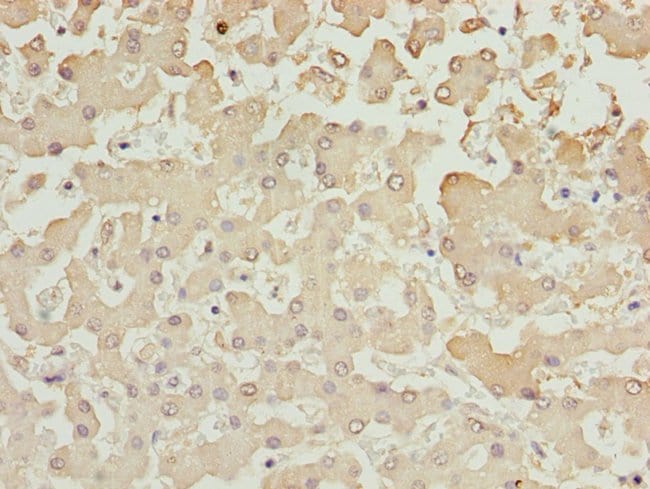 100UL AKR7A2 ANTIBODY 100 ul