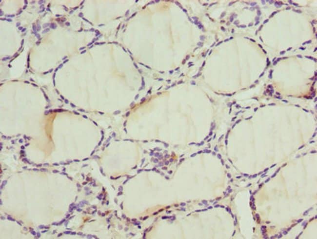 100UG ALAS2 ANTIBODY 100 ug