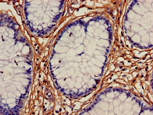 100UG ALDH1A2 ANTIBODY 100 ug