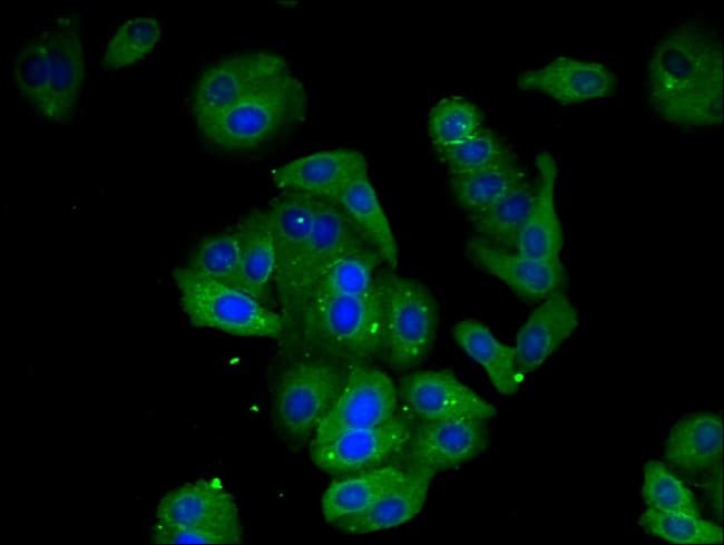 100UG AMD1 ANTIBODY 100 ug