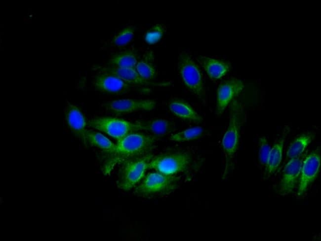 100UG ALDH3B1 ANTIBODY 100 ug