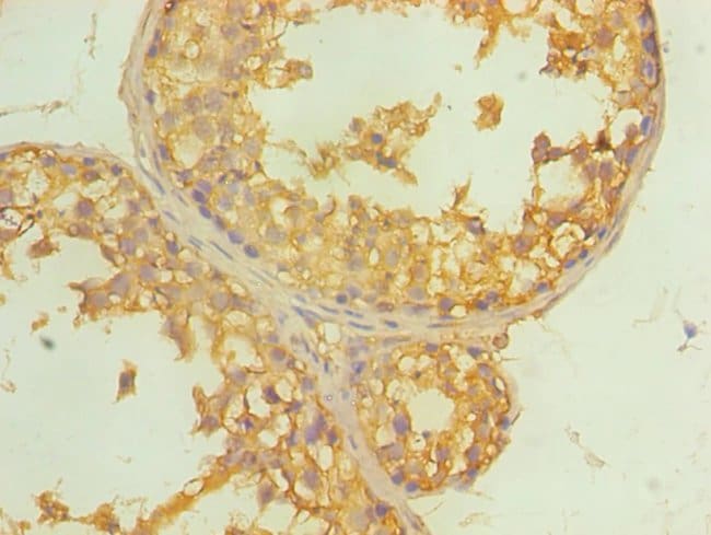 100UL ALDH4A1 ANTIBODY 100 ul