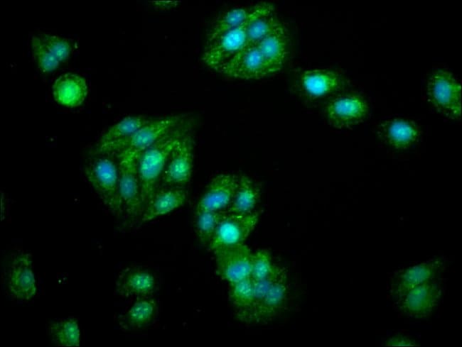 100UG ALDH5A1 ANTIBODY 100 ug
