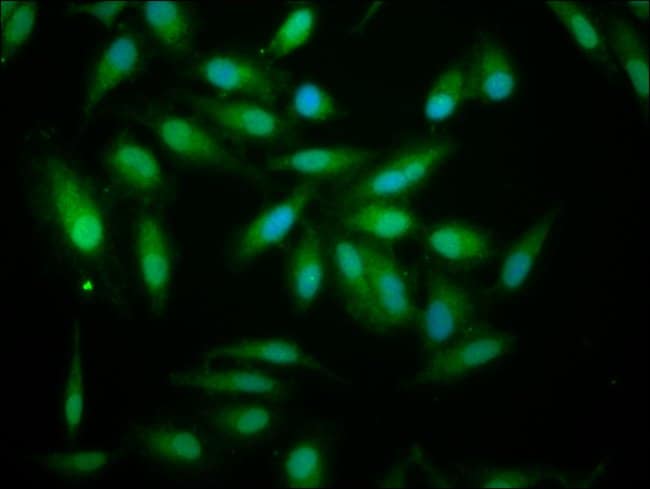 100UG ALDH7A1 ANTIBODY 100 ug