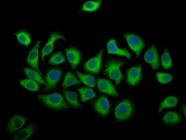 100UG ALOX12 ANTIBODY 100 ug